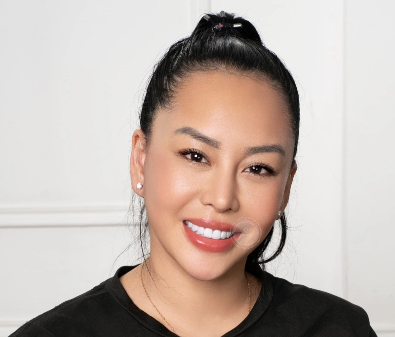 Bảng giá dán sứ Veneer 2025 | Dán sứ Veneer giá bao nhiêu 1 răng?